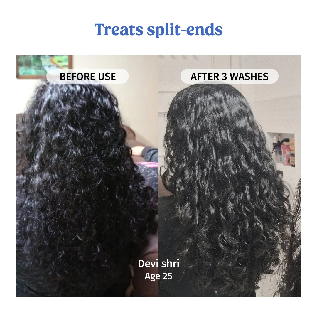 Bestseller Hair Combo - Image 5