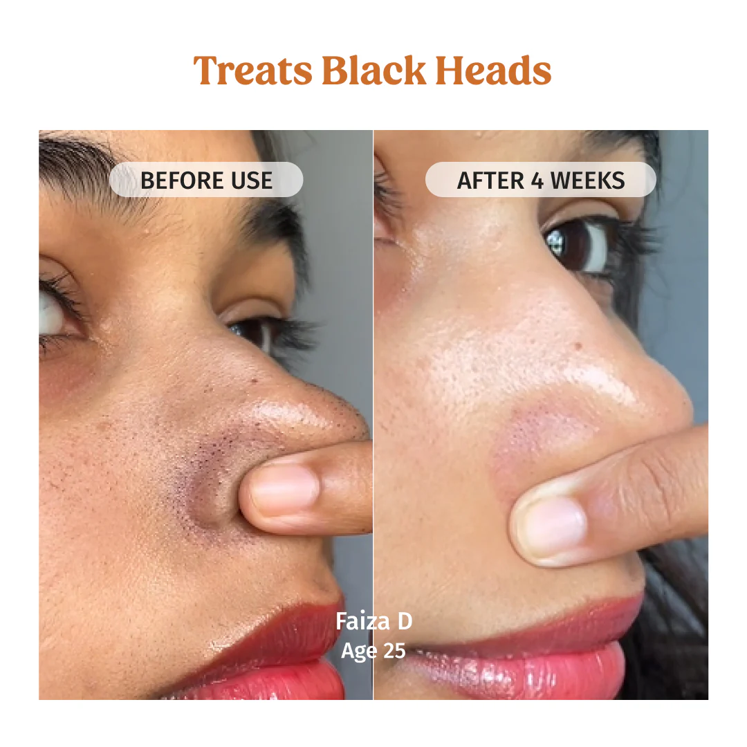 Face Brightening Combo - Image 4
