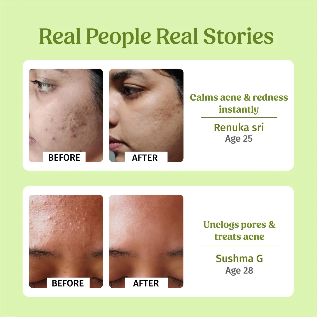 Sensitive Skin Combo - Image 5