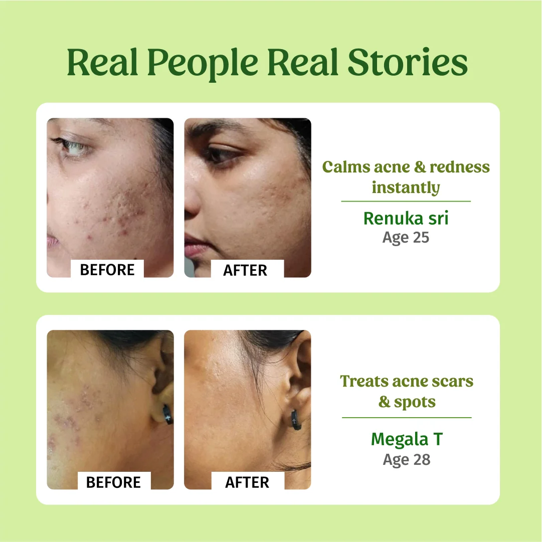 Aloe Vera Gel - Image 5