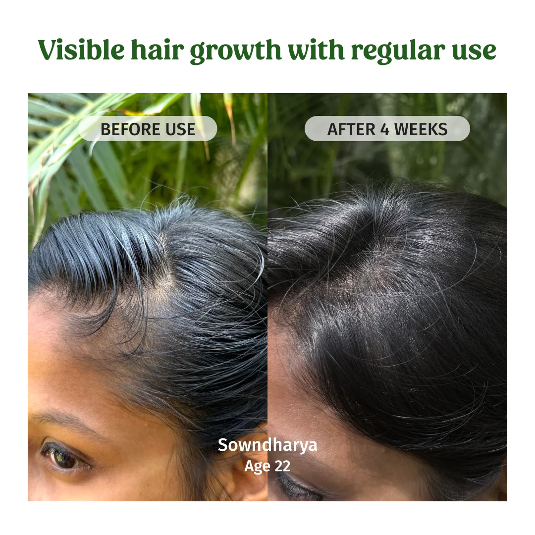 Hair Regrowth Oil - Image 3