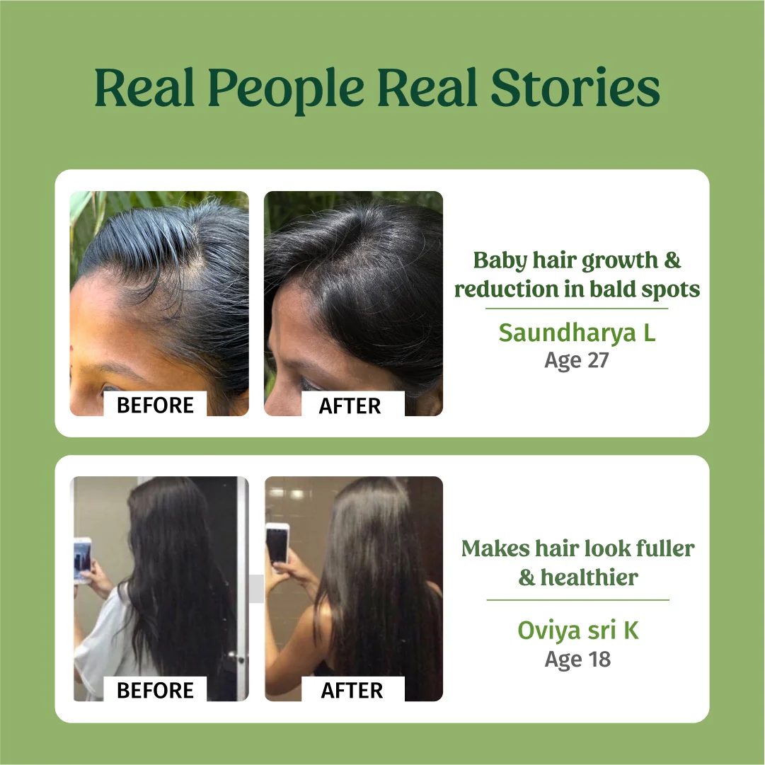 Hair Strengthening Combo - Image 4