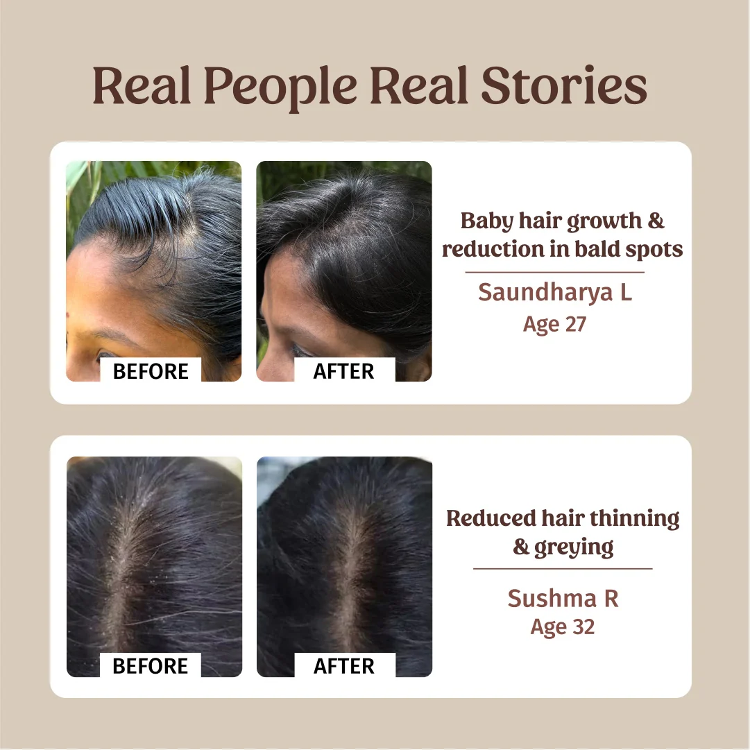 Hairfall Control Combo - Image 4