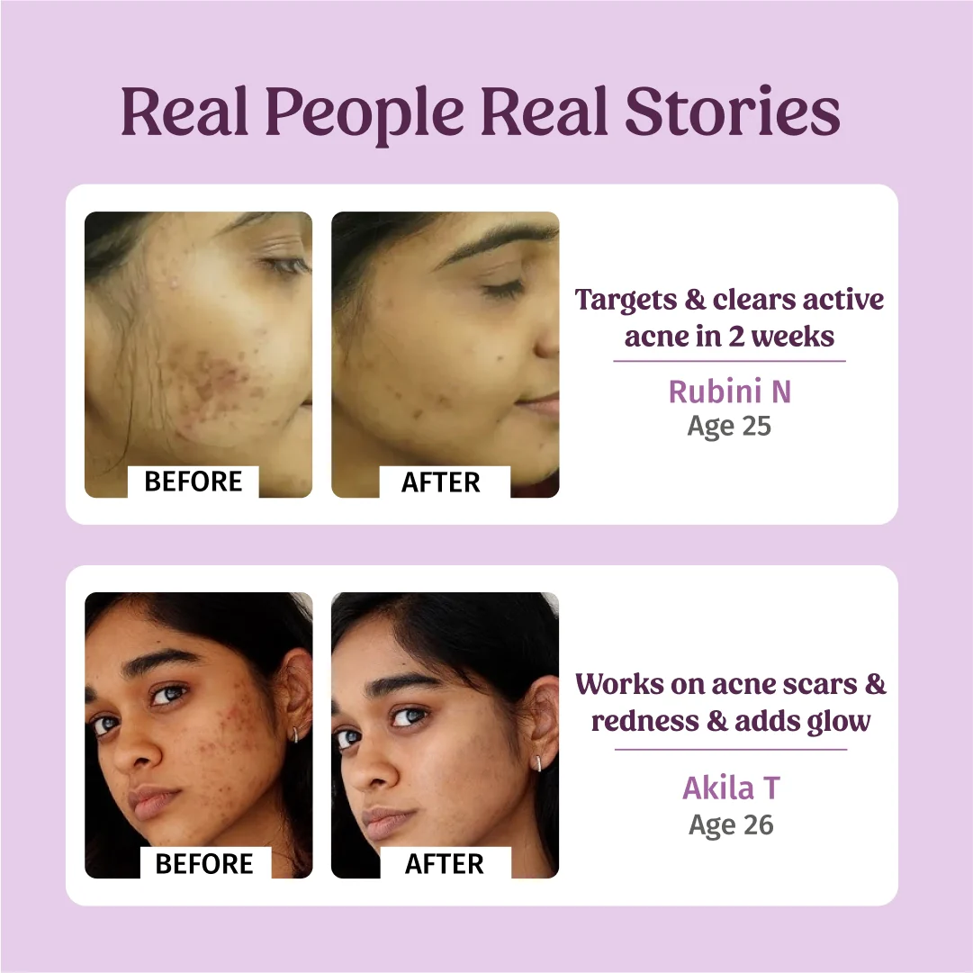 Honey Fix Face Wash - Image 5