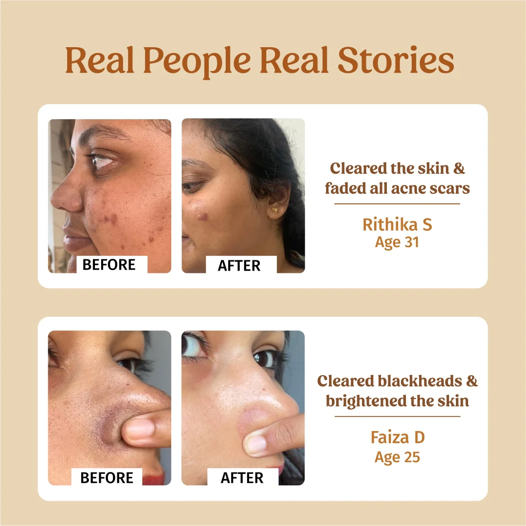Large Face Brightening Combo - Image 4