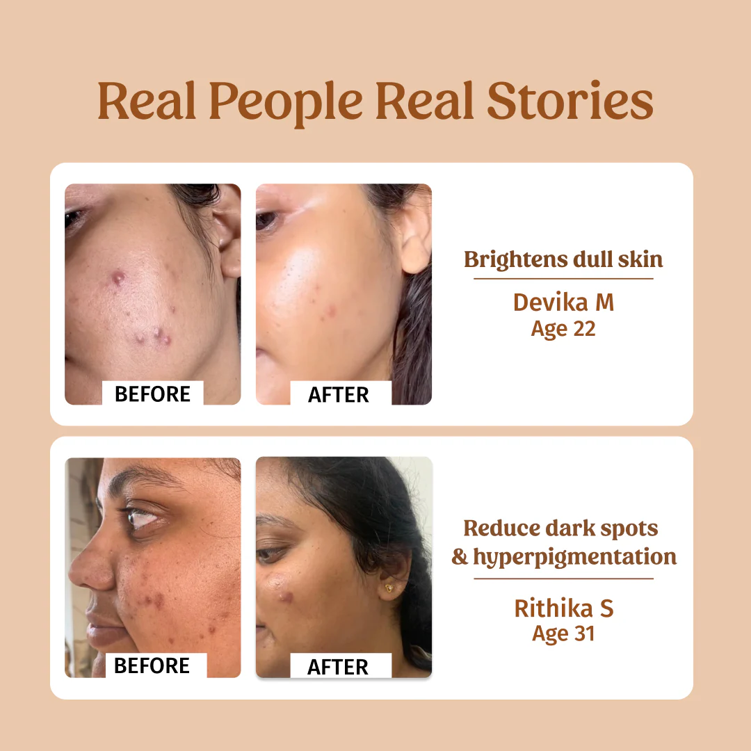 40ml Milk Drops Brightening Serum - Image 5