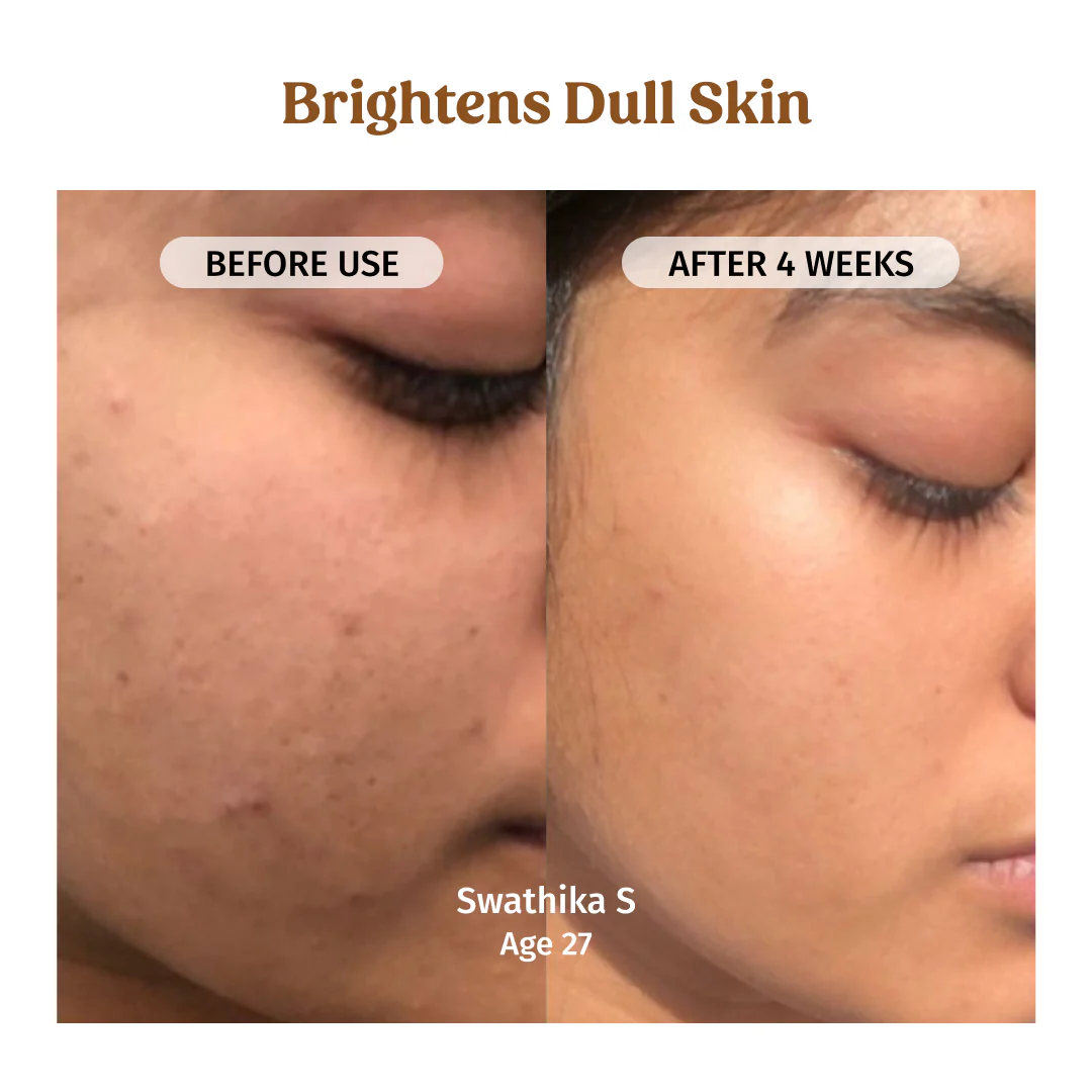 Milk Drops Brightening Serum - Image 5