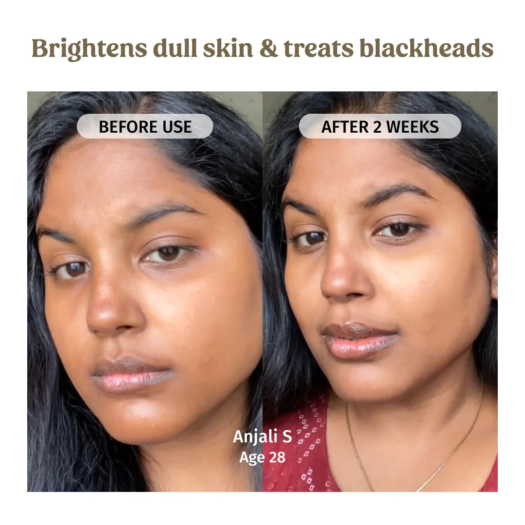 Milk Mud Mask - Image 4