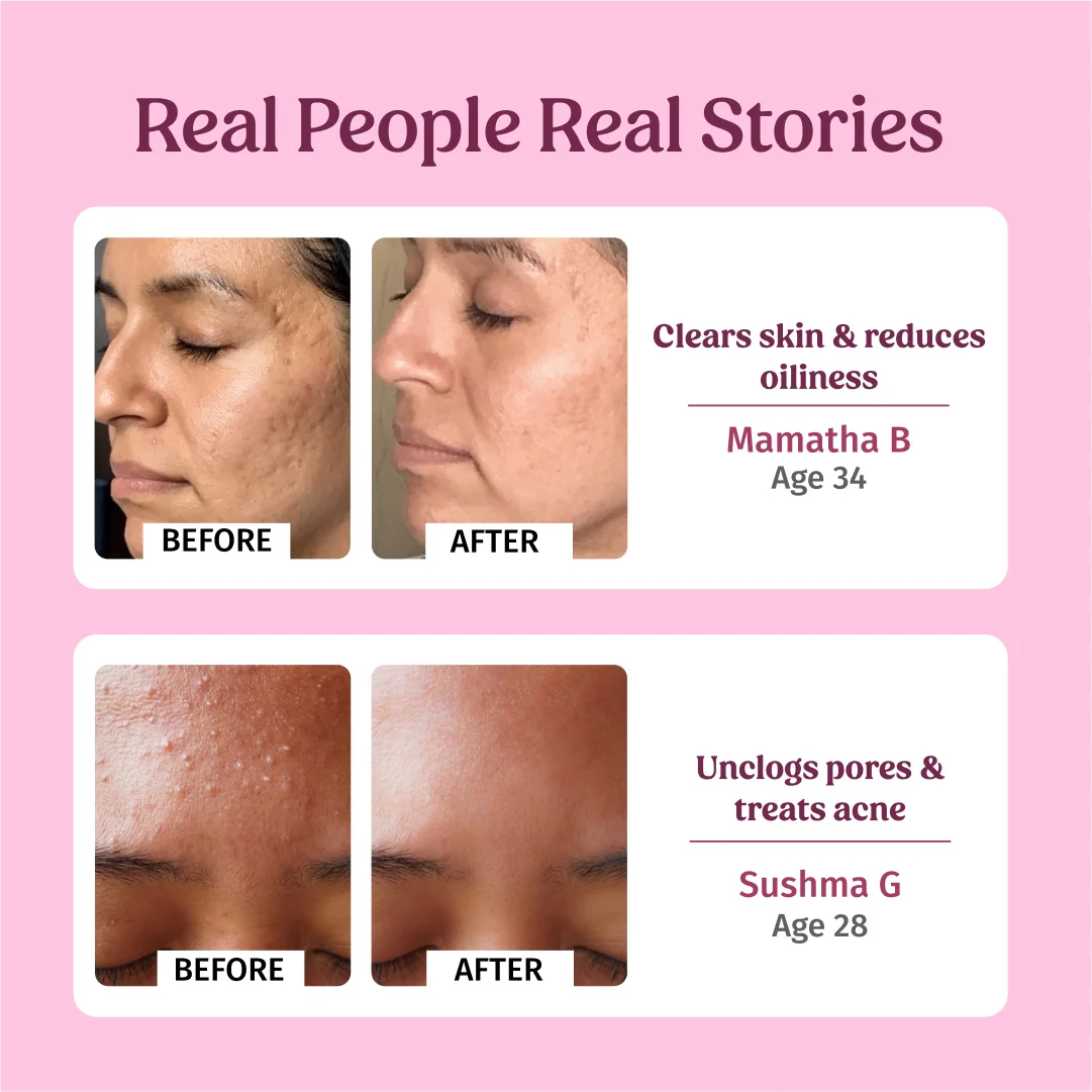 Rose Water Facial Toner - Image 5