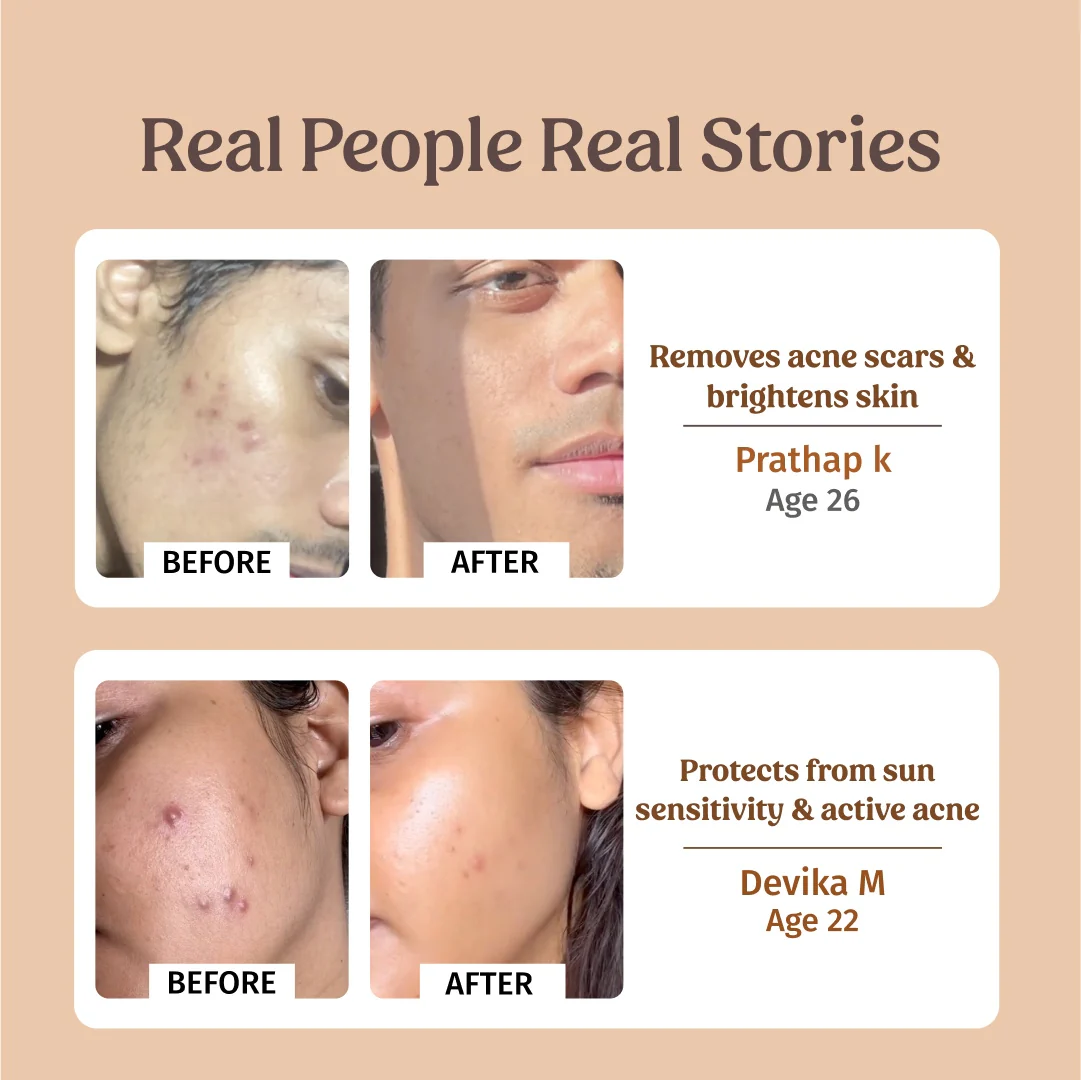 Skin Brightening Combo - Image 5