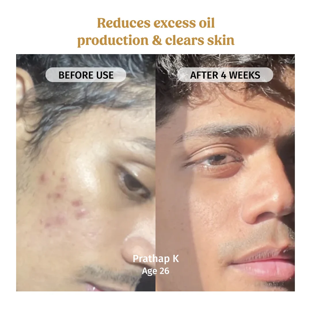 Skin Glow Combo - Image 3