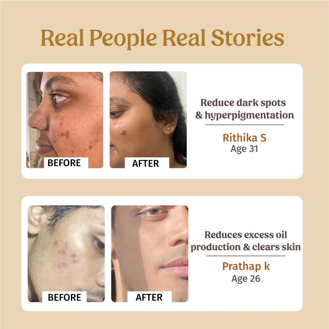 Skin Hydration Combo - Image 5